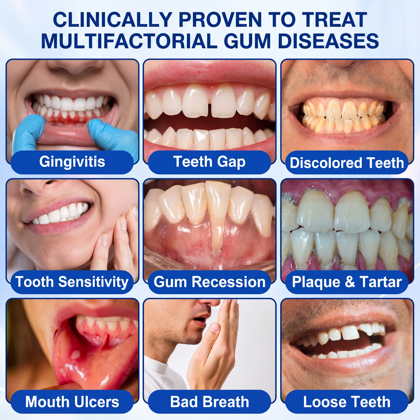 🇺🇸Pureluxo® 🦷GumRevive periodontal repair gel🌿