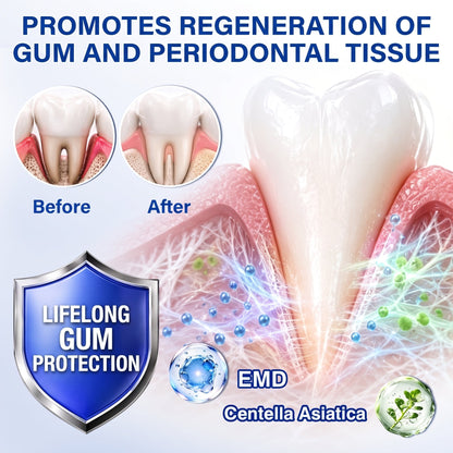 🇺🇸Pureluxo® 🦷GumRevive periodontal repair gel🌿