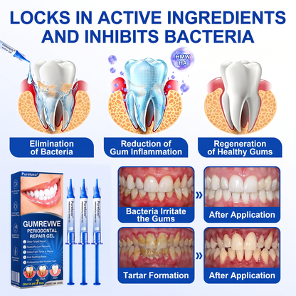 🇺🇸Pureluxo® 🦷GumRevive periodontal repair gel🌿